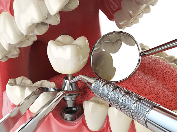 Best Walk-In Emergency Dental Services in Smithfield, NC